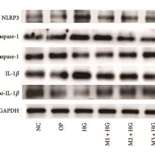 The Mrna Expression Of Nlrp Caspase And Il In Mesangial Cells