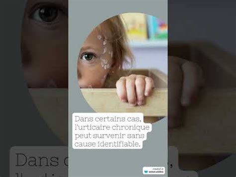URTICAIRE Symptomes Et Comment Calmer Les Boutons Durticaire YouTube