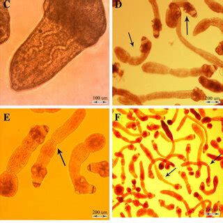 In Vitro Developmental Stages Of Echinococcus Granulosus In Monophasic