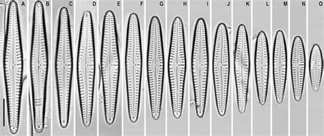 A O Gomphonema Medioasiae Light Microscopy Differential