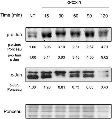 Frontiers C Jun Proto Oncoprotein Plays A Protective Role In Lung