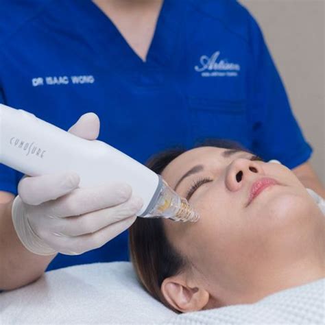 Potenza The Microneedling And Skin Revitalisation Treatment Of The