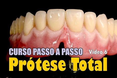 ACABAMENTO PRÓTESE TOTAL Curso passo a passo Video 6