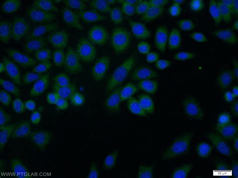 Tcp Antibody Ap Proteintech