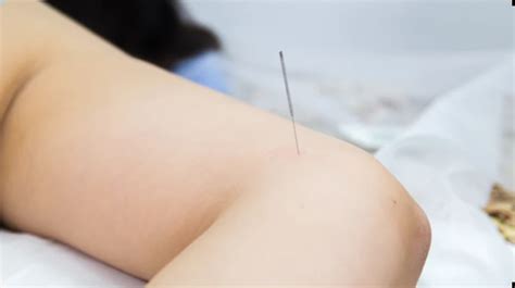 Tennis Elbow Acupuncture Adelaide Af Health Acupuncture