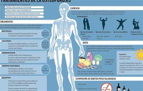 Osteopenia riesgos síntomas y tratamientos