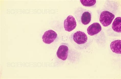 Pneumocystis Jirovecii Lm Stock Image Science Source Images