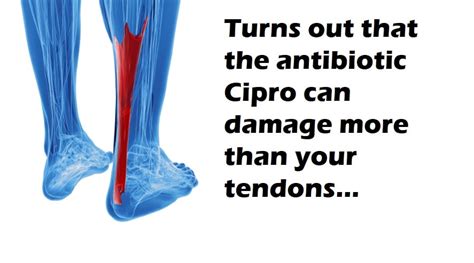 Cipro Side Effects