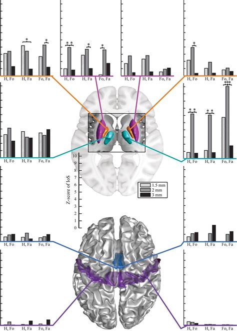 Frontiers Spatial Resolution And Imaging Encoding Fmri Settings For