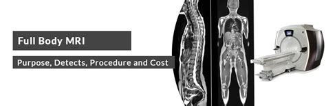 Full Body MRI Purpose Detects Procedure Cost And Best MRI Centre In