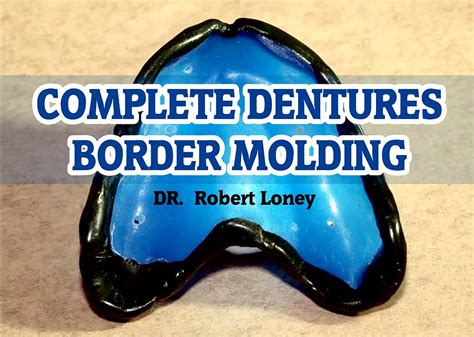 Complete Dentures Border Molding Robert Loney