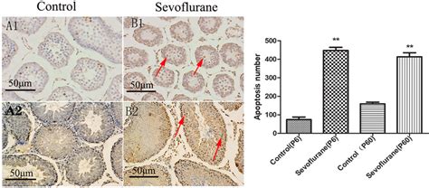 Tunel Staining For Cell Apoptosis Of Testicular Tissue In The