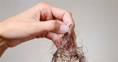 The Mysterious Case Of Falling Locks: 6 Surprising Truths About Normal Hair Loss