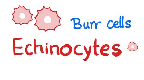 Echinocytes (Burr Cells) - YouTube