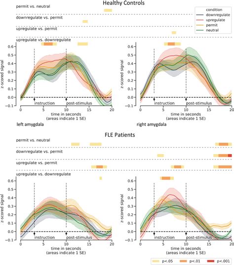 Time Courses For The Left And Right Amygdala In Both Groups In The