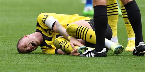 BVB Marco Reus Droht Lange Pause