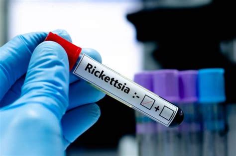 Alertan por rickettsia en México Qué es cómo se contagia y síntomas