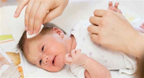 ¿cómo Limpiarle La Cara Al Bebé Newborn Skin Peeling Cradle Cap