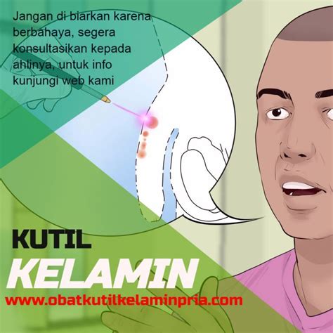 Anjuran Obat Kutil Kelamin Kimia Farma Atau K Upstart