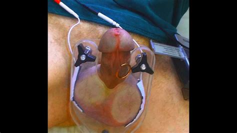 Pressed Balls Electro Cum Free Gay Bdsm Porn C Xhamster Xhamster