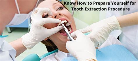 Know How To Prepare Yourself For Tooth Extraction Procedure