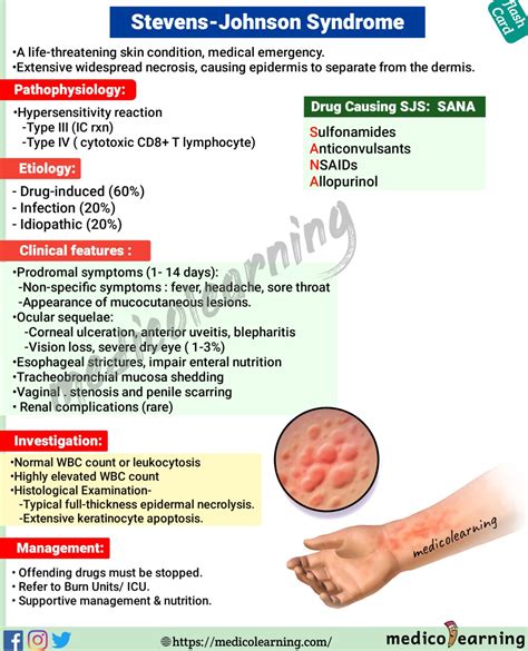 Stevens Johnson Syndrome – MedicoLearning