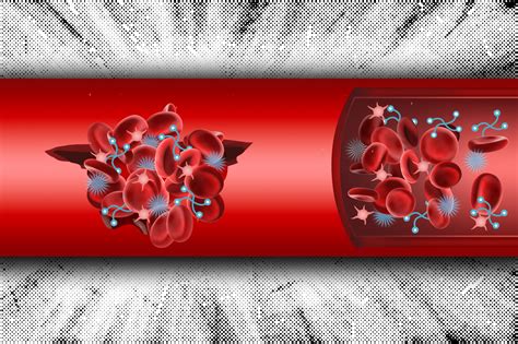 Two Component System Could Offer A New Way To Halt Internal Bleeding