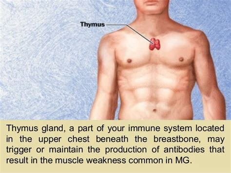 pharmacology of myasthenia gravis