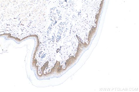 Cd44 Antibody 15675 1 Ap Proteintech 武汉三鹰生物技术有限公司