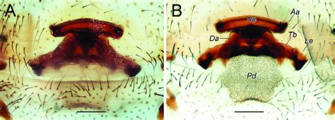 Female of Dysdera achaemenes sp. nov., endogyne. A ventral view B... | Download Scientific Diagram