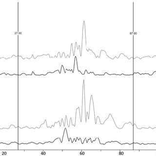 averaged ipsi   contralateral  nociceptive blink reflex