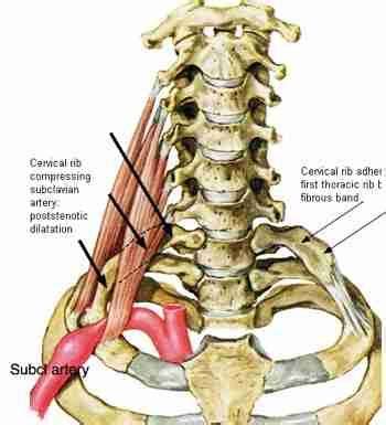 Ribs Anatomy Types Ossification Clinical Significance