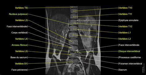 Rachis lombaire : anatomie normale | e-Anatomy