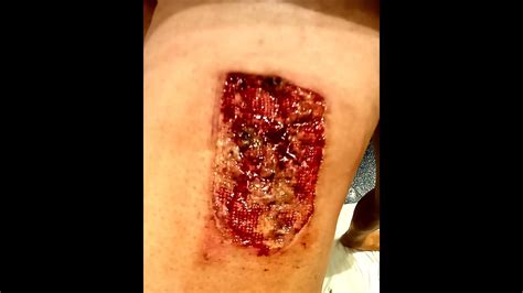 So You Want To Have Sex Change Surgery YouTube