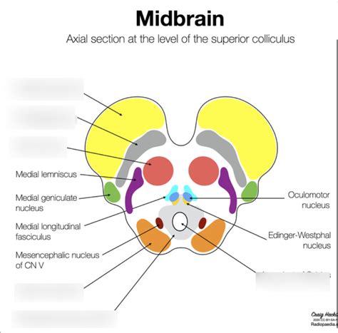 Cross Section of MidBrain Diagram | Quizlet