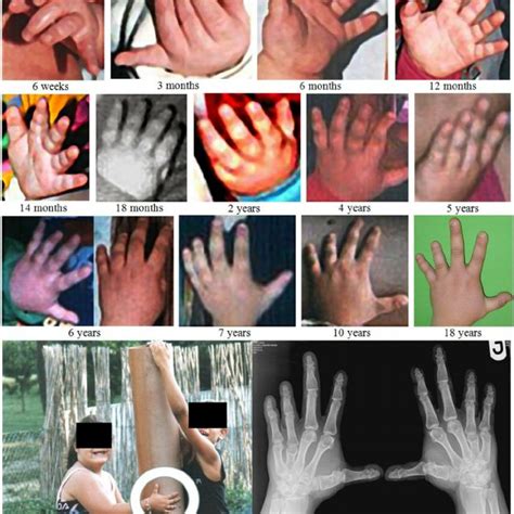 Craniofacial Phenotype Download Scientific Diagram