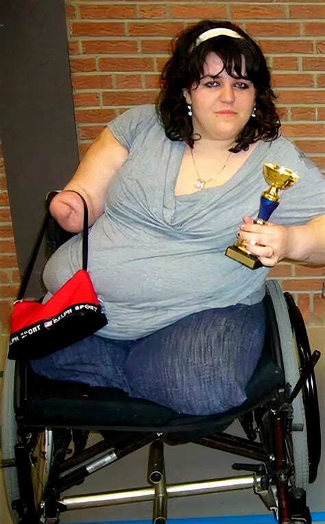 Obese triple-amputee by SteveH51 on DeviantArt