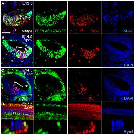 In Vivo Canonical Wnt Catenin Reporter Activity In The Mouse