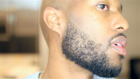 Minoxidil Beard Journey Year 2 Week 10 Youtube