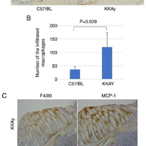 Macrophage Infiltration And MCP 1 Expression In Murine Colon Lamina