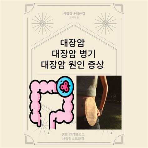 대장암 1기 2기 3기 4기 병기 대장암 원인 증상 용종제거 대장암 발생과정 네이버 블로그