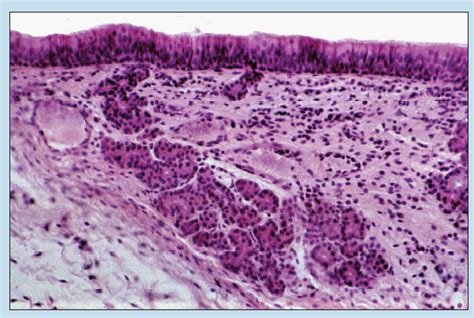 Larynx Histology Slide