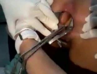 Cirurgia Para Retirada De Brinquedo Erotico Do Cu Brazilian Anal Porn Xhamster