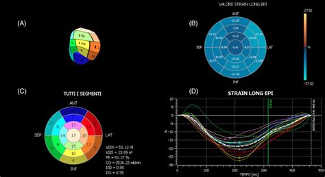 Xstrain 4d Main Window After Spatial Alignment Of The 3 Apical Views Download Scientific