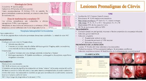 Portafolio Electr Nico De Ginecolog A Lesiones Premalignas Y Malignas