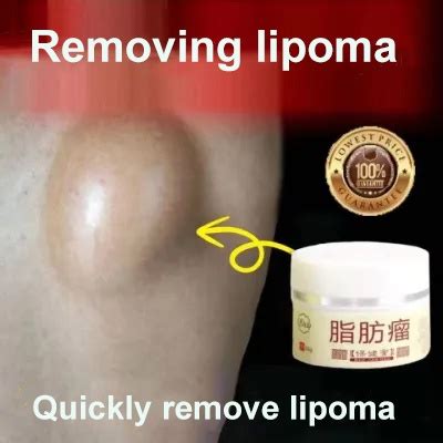 Lipoma Removal Cream Ointment G Lipolysis Fat Lump Fatty Cellulite