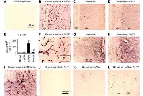 Serotonin 5 Hydroxytryptamine 5 Ht Synthesis From Exogenous