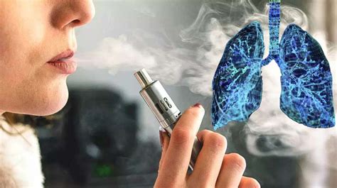 Substantial Evidence Of Link Between Vaping And Lung Disease As Patient