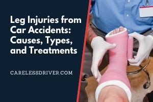 Leg Injuries From Car Accidents Causes Types Treatments Florida