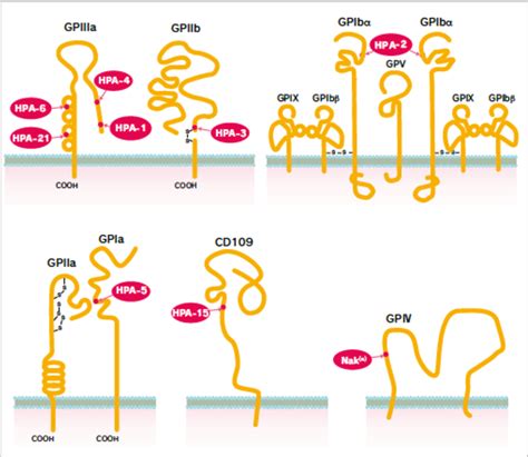 Figure 1 From Fetal And Neonatal Alloimmune Thrombocytopenia